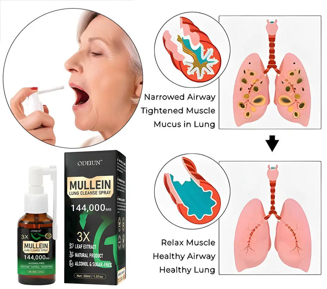 🌿 3X Mullein Lung Spray - Image 2