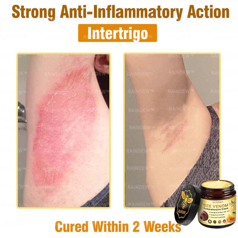 Bee Venom Comprehensive Cream - Image 8