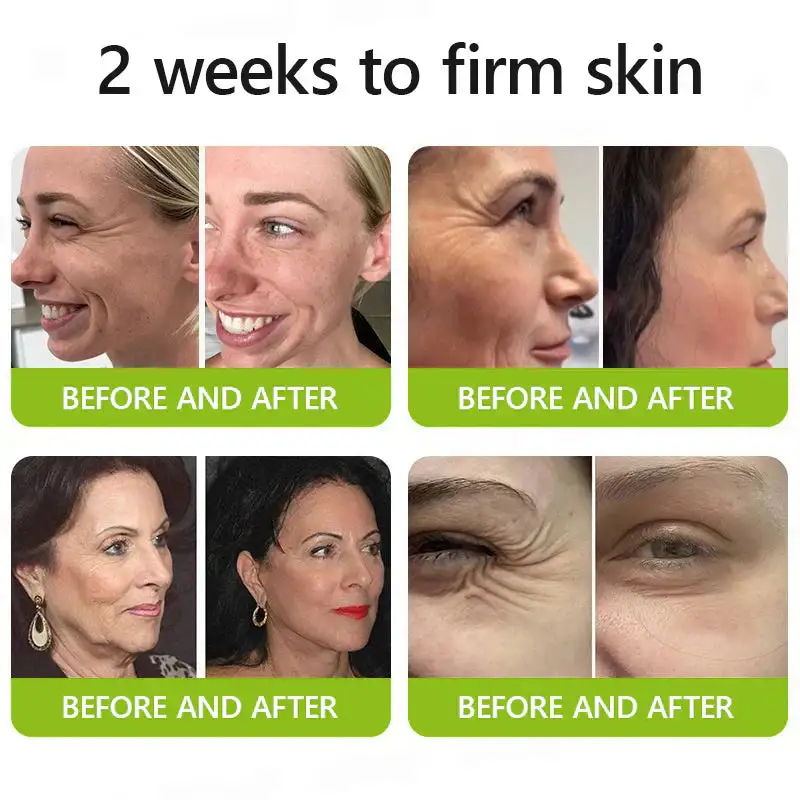 BOTOX & VITA A RETINOL SHOT Wrinkle Lift Tightening Cream - Image 13