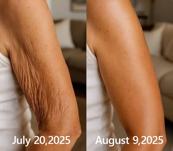 BOTOX & VITA A RETINOL SHOT Wrinkle Lift Tightening Cream - Image 40
