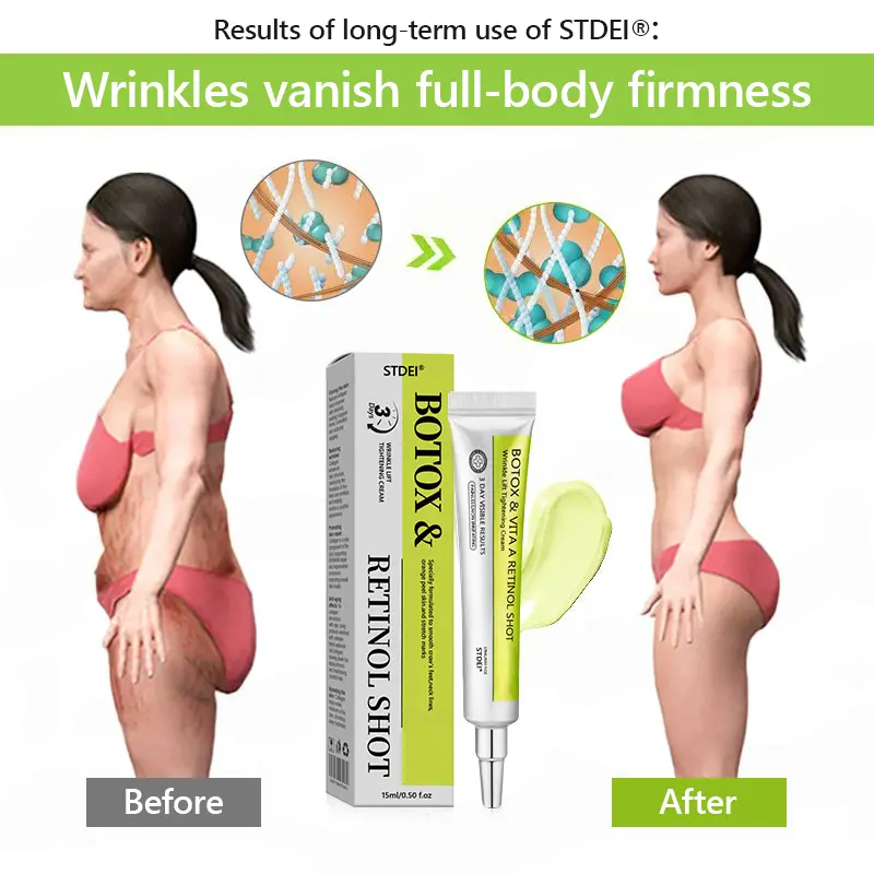 BOTOX & VITA A RETINOL SHOT Wrinkle Lift Tightening Cream - Image 43