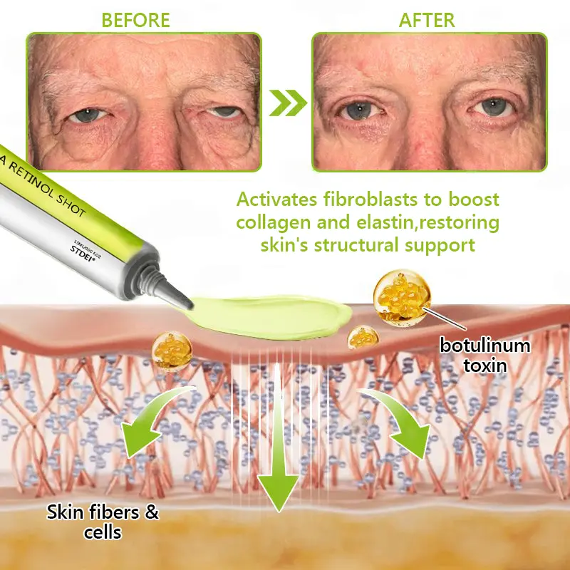 BOTOX & VITA A RETINOL SHOT Wrinkle Lift Tightening Cream - Image 48