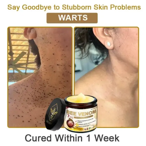 Bee Venom Skin Comprehensive Cream - Image 10