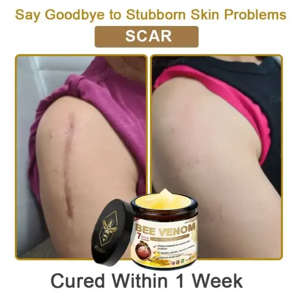 Botox Bee Venom Skin Treatment Cream - Image 11