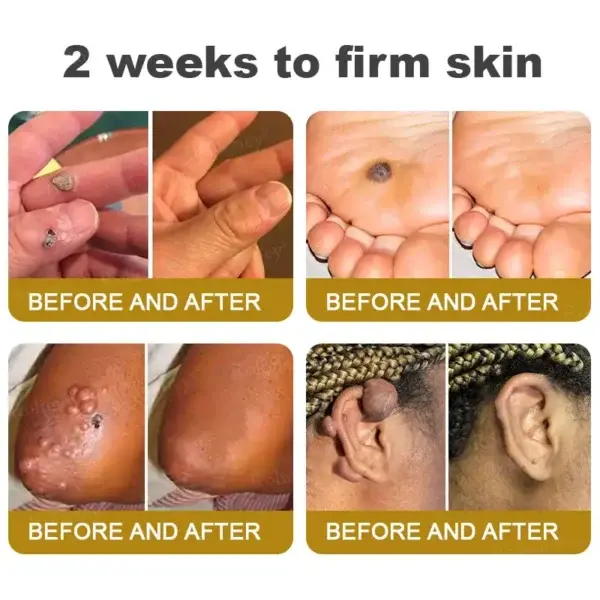 Botox Bee Venom Skin Treatment Cream - Image 5