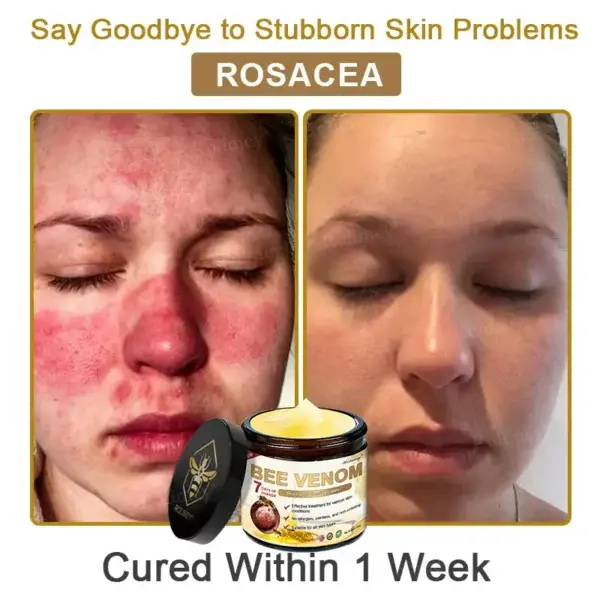 Botox Bee Venom Skin Treatment Cream - Image 6