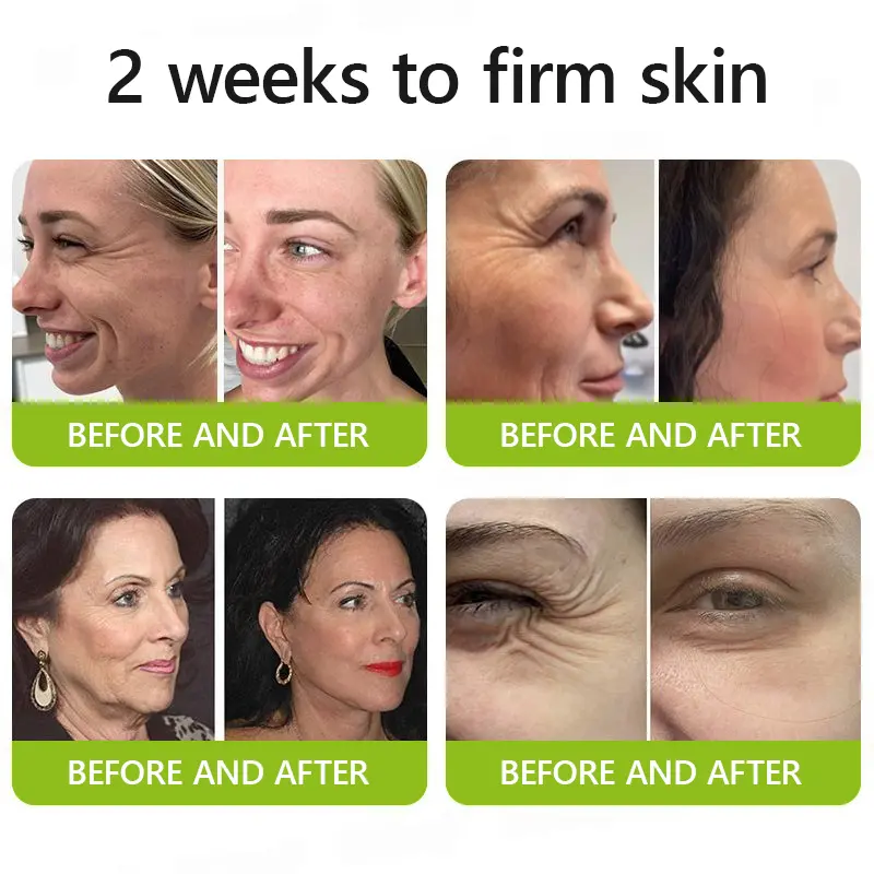 Botox & Vitamin A Retinol Shot Anti-Wrinkle Firming Cream - Image 3