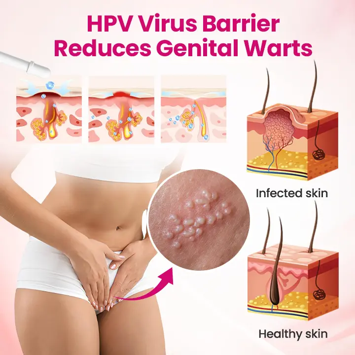 IntiDefend Anti-HPV Interferon Gel - Image 9