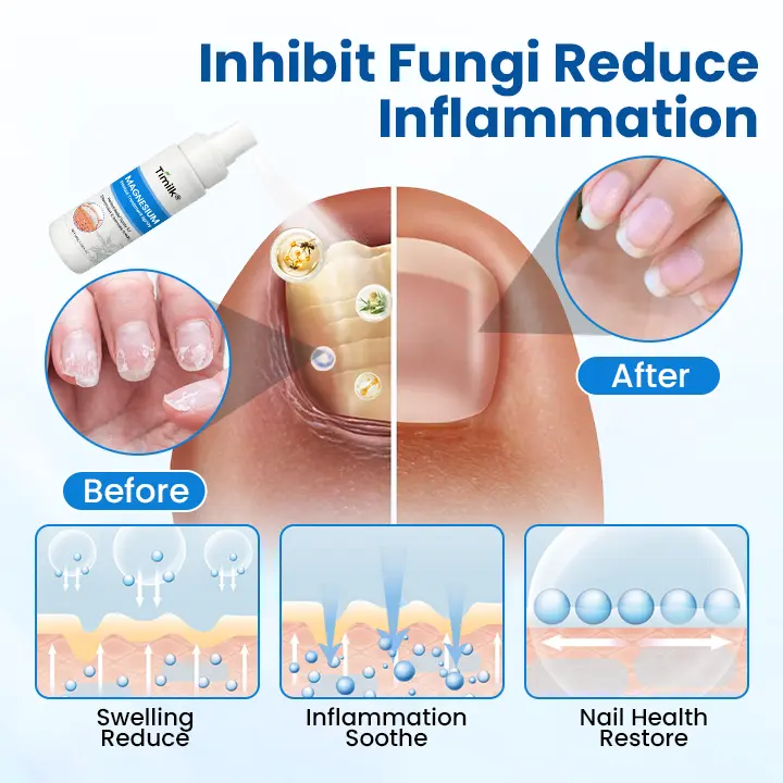 Magnesium Herbal Treatment Spray - Image 10