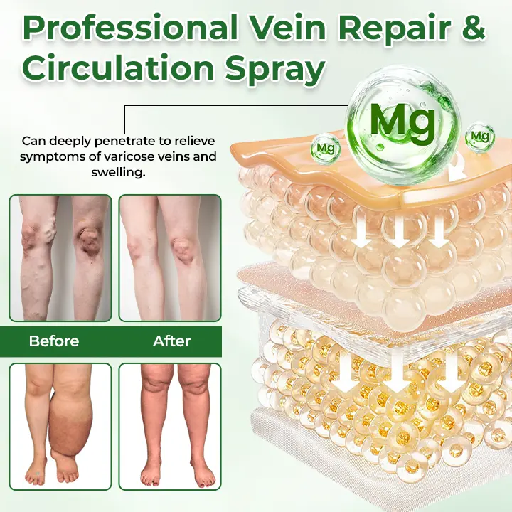 VeinFlex Magnesium Relief Spray - Image 3
