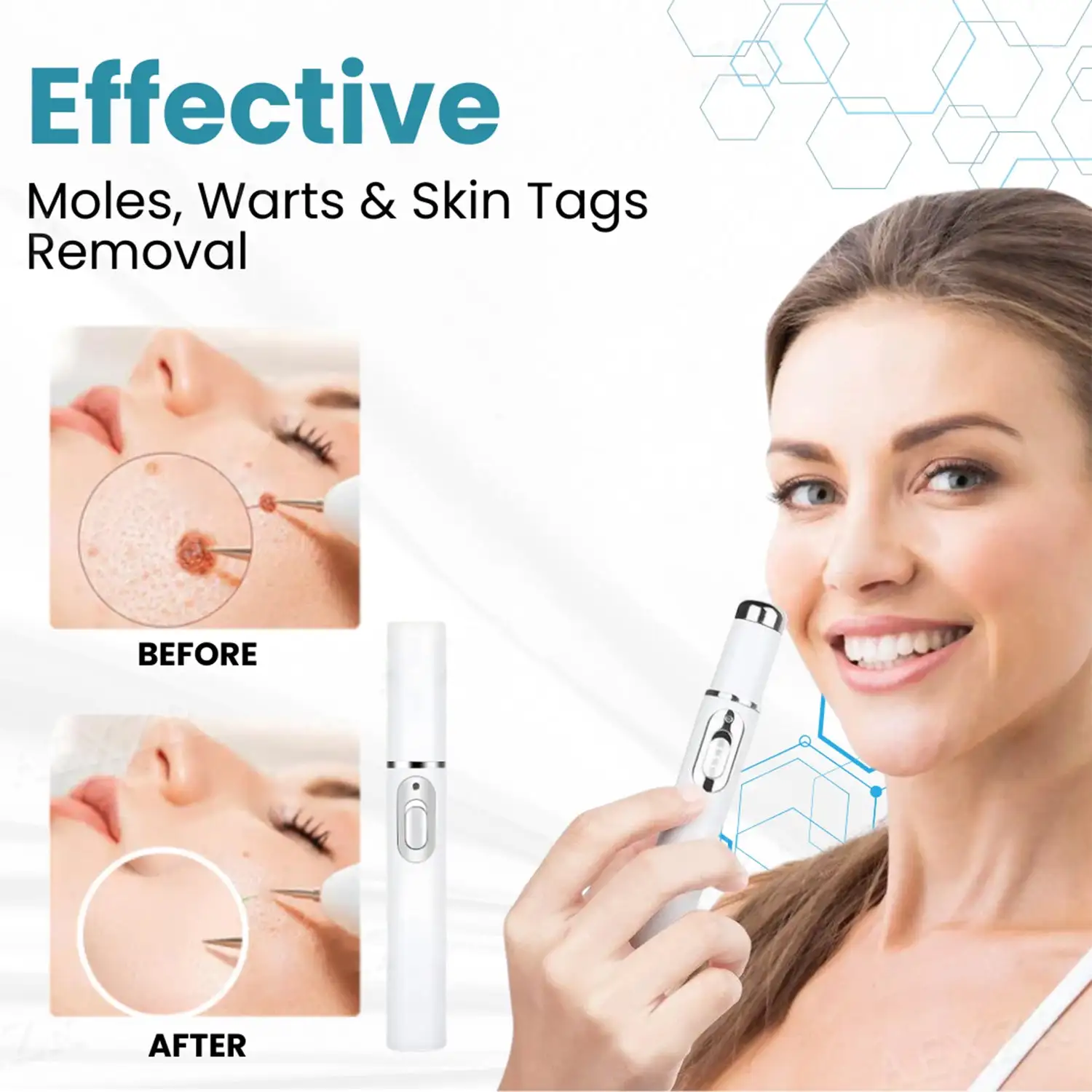 non-invasive laser pen delivers hospital-grade results at home - Image 10