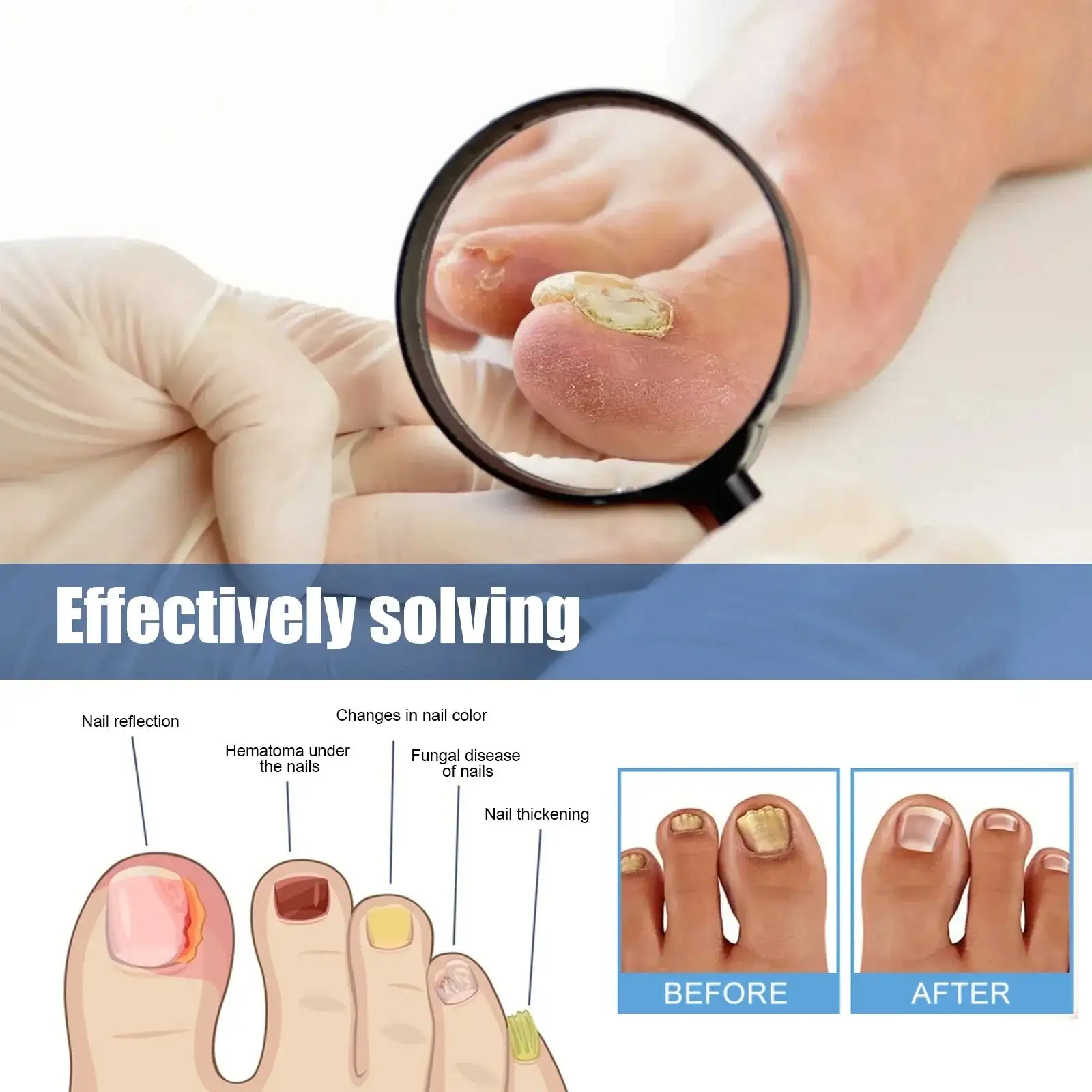 Fungus Nail Repair Patches - Image 5