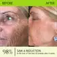 BOTOX & VITA A RETINOL SHOT Wrinkle Lift Tightening Cream - Image 36