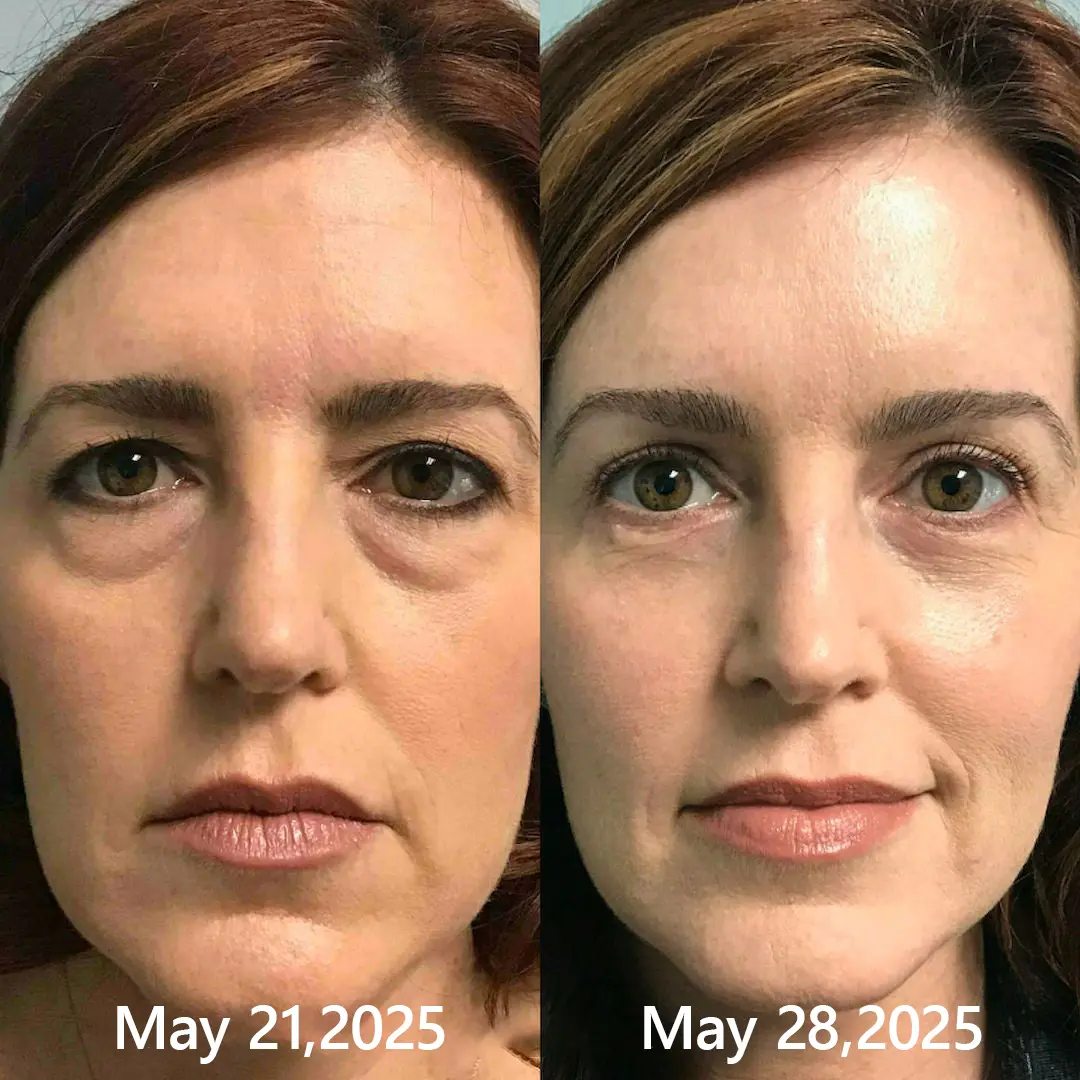 BOTOX & VITA A RETINOL SHOT Wrinkle Lift Tightening Cream - Image 49