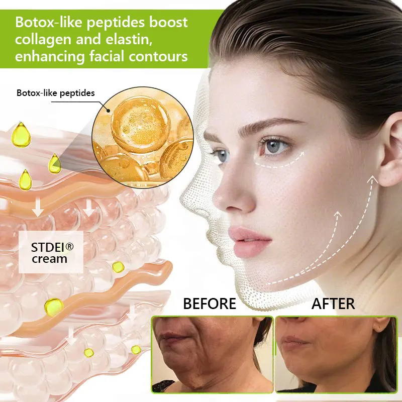 BOTOX & VITA A RETINOL SHOT Wrinkle Lift Tightening Cream - Image 57