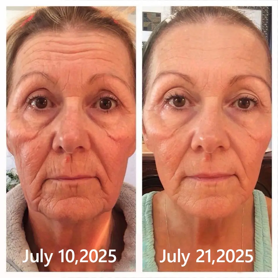 BOTOX & VITA A RETINOL SHOT Wrinkle Lift Tightening Cream - Image 51