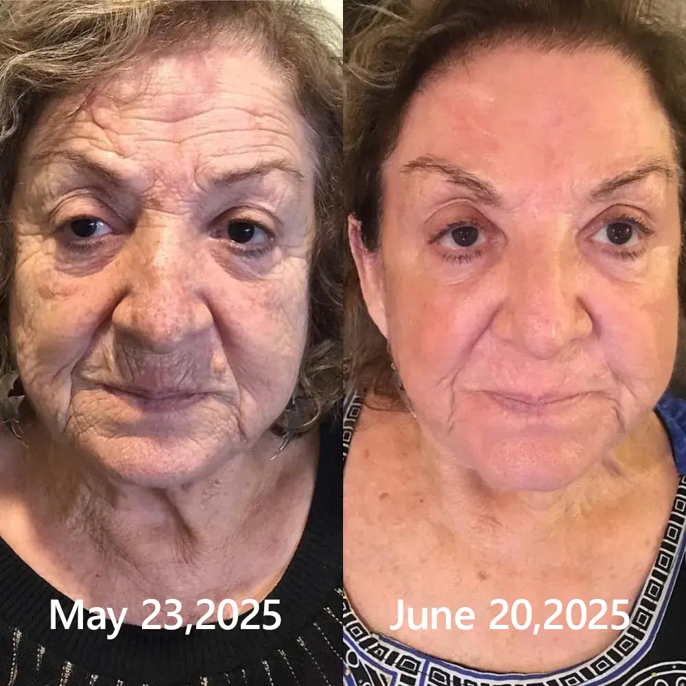 BOTOX & VITA A RETINOL SHOT Wrinkle Lift Tightening Cream - Image 53