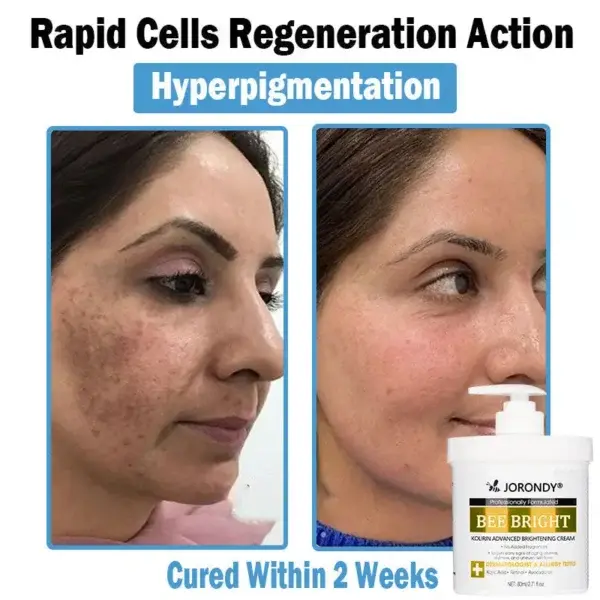 Bee Bright Multi-Symptom Skin Treatment Cream - Image 9