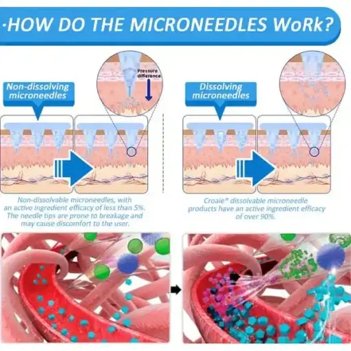 CROAIE Nano Microneedle Patch - Image 2