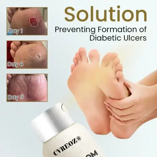 Bee Venom Diabetic Foot Healing Spray - Image 4