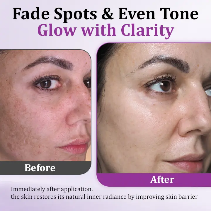 MelantraX Advanced Anti-Hyperpigmentation Essence - Image 6