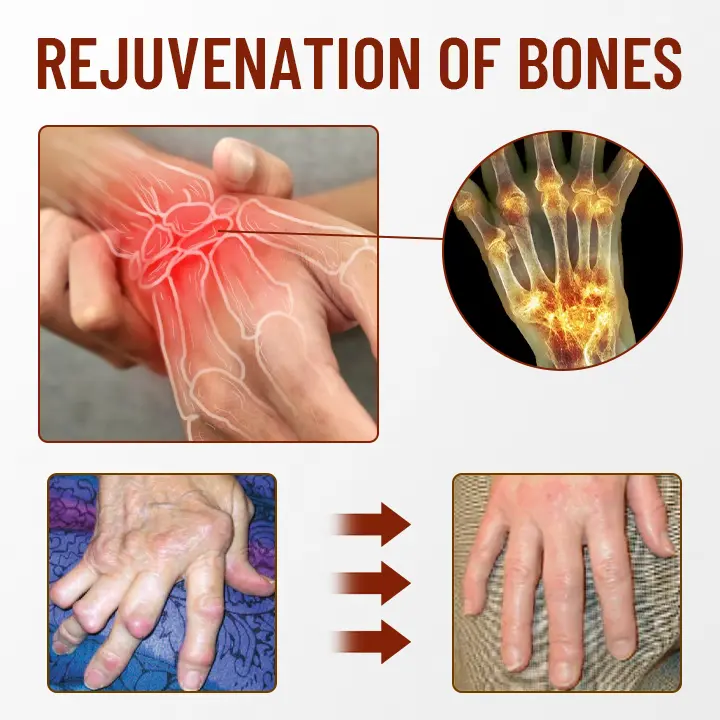 Bone Soothing Turmeric Therapy Spray - Image 4