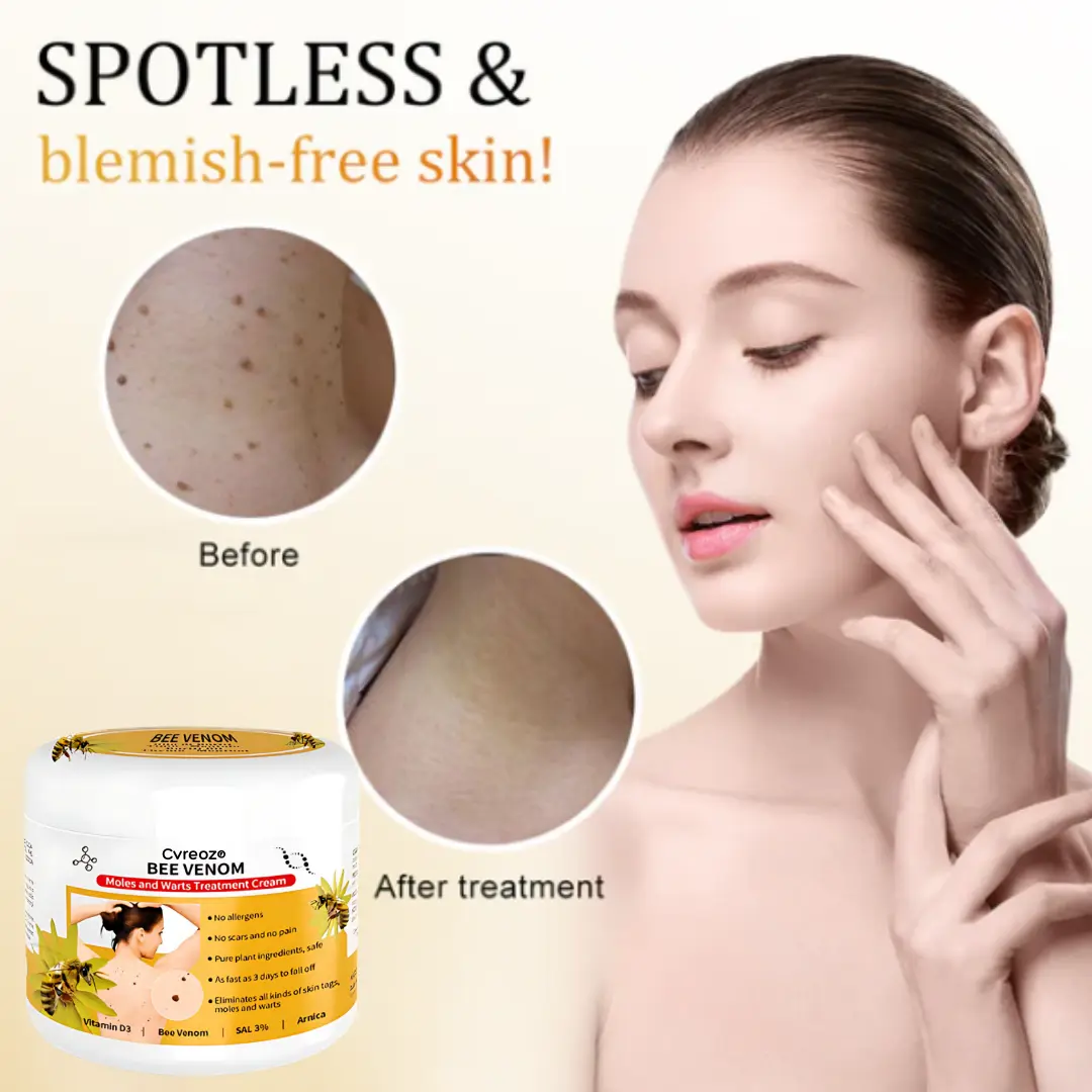 Bee Venom Mole and Wart Treatment Cream - LIMITED-TIME OFFER - Image 16