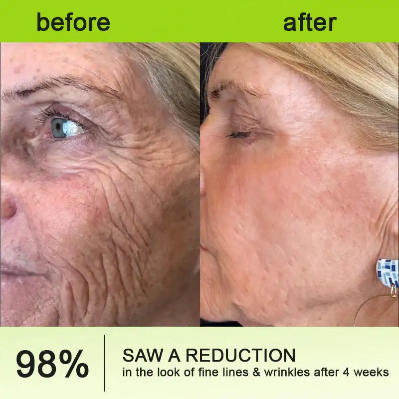 Botulinum & Vita-A Complex Shot Wrinkle-Lift Tightening cream - Image 7