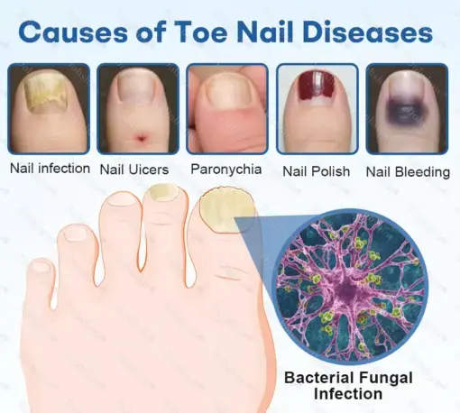 Nano Rapid Clear Nail Fungus Rapair Liquid Effective in 7 Days, Permanently Eliminates the Root - Image 5