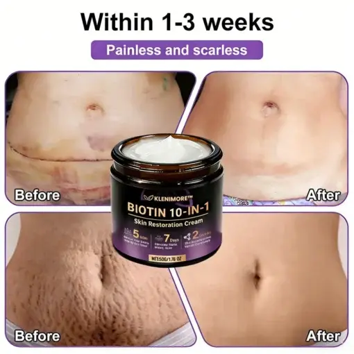 Biotin 10-in-1 Skin Restoration Cream - Image 5