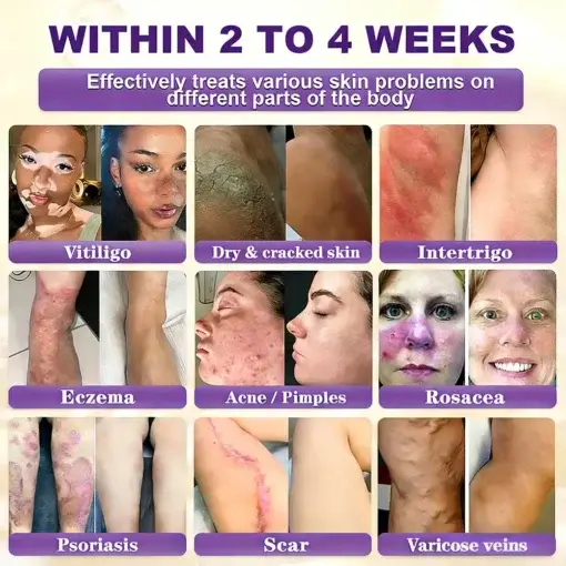 Biotin 10-in-1 Skin Restoration Cream - Image 8