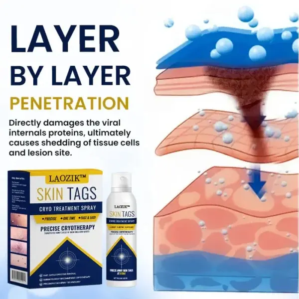 Skin Tag Cryo Treatment Spray - Image 3
