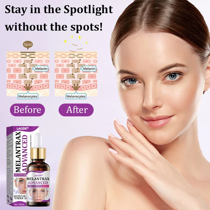 MelantraX Advanced Anti-Hyperpigmentation Essence - Image 2