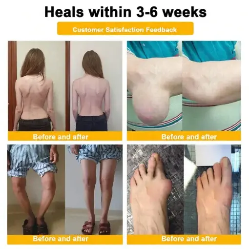Bee Poison Pain-Relief Bone Healing Cream (Specially for older adults) - Image 6