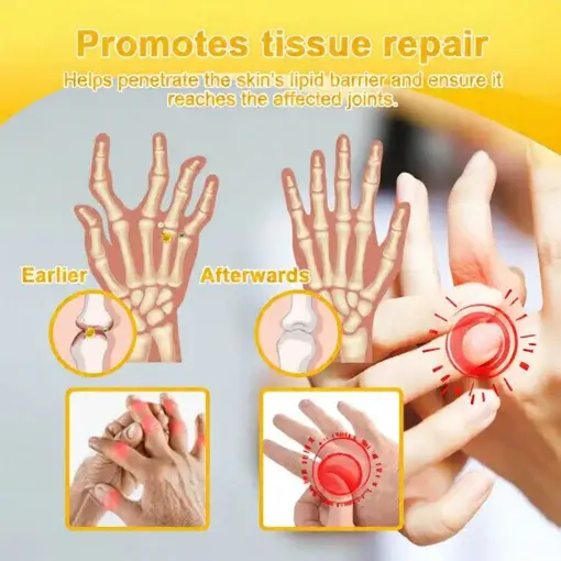 Bee Poison Pain-Relief Bone Healing Cream - Image 13
