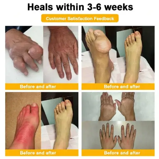 Bee Poison Pain-Relief Bone Healing Cream - Image 4