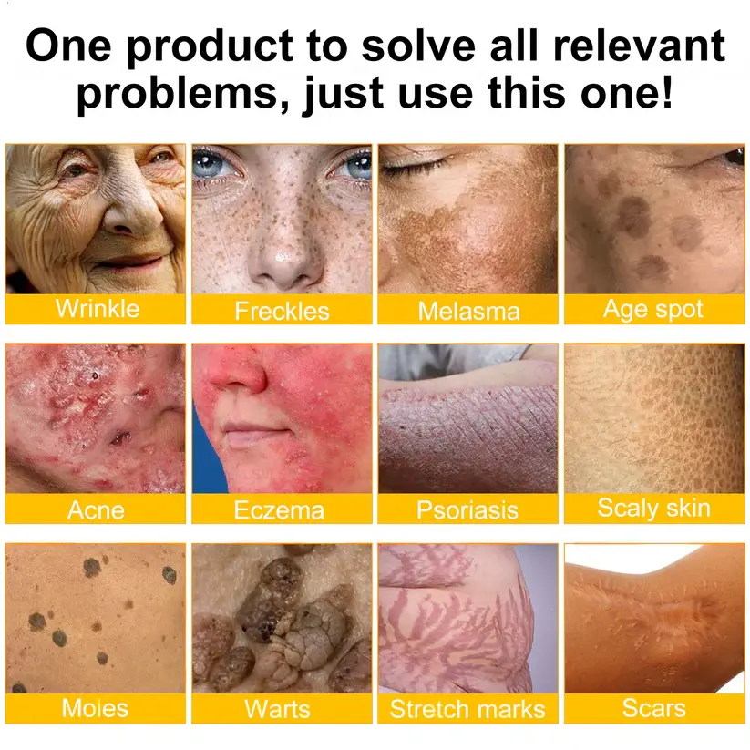 🐝Bee Poison Skin Restoration Cream 🐝 - Image 7