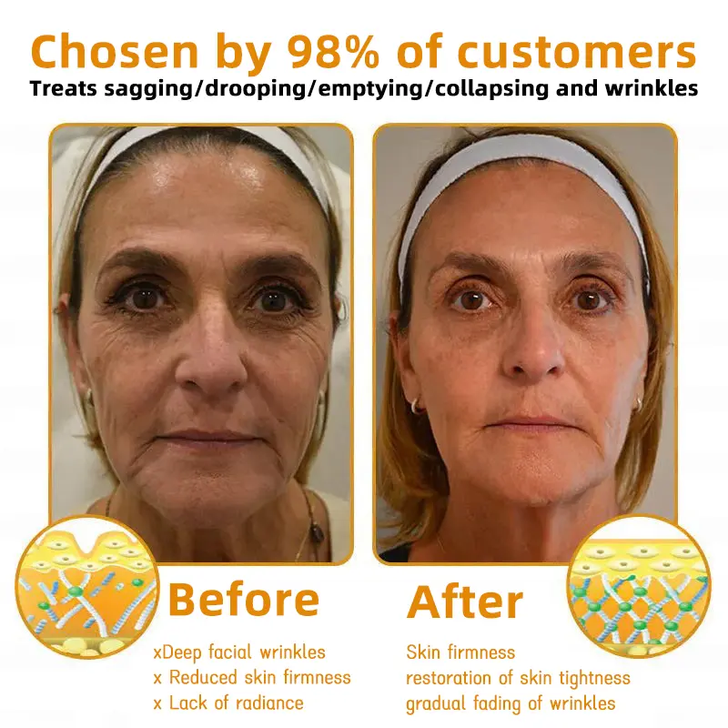 Bee Poison Skin Restoration Cream - Image 6