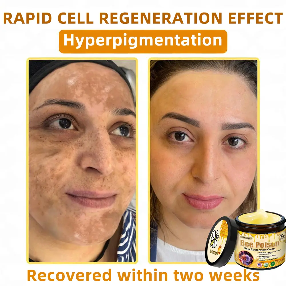 🐝Bee Poison Skin Restoration Cream 🐝 - Image 10