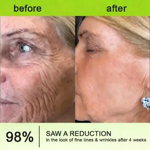 moringa Vita-A Retinol Shot Wrinkle-Lift Tightening cream – Last Day Promotion 50 OFF - Image 11