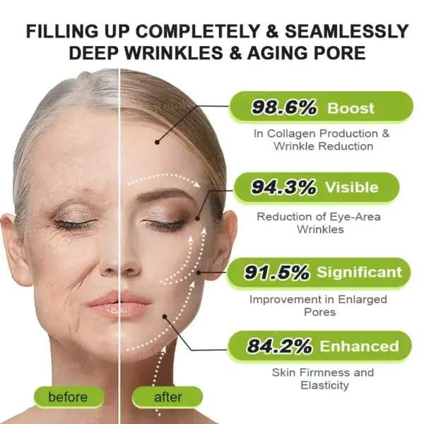 Last Day! 70% OFF 💫 Botox & Vita-A Retinol Wrinkle-Lift Cream – Made & Shipped from CA 🔥 - Image 16