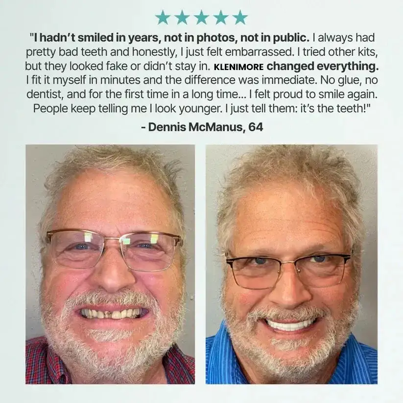 🌎Limited-Time Sale Ends Easter! Medical Full Denture with Strong Suctiond - Image 11