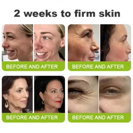 Botin Vita-A Retinol Shot Wrinkle-Lift Tightening cream – Last Day Promotion 70 OFF - Image 4