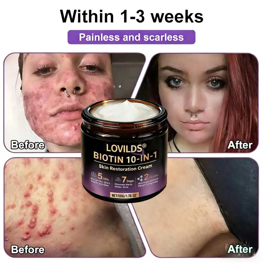 Made and Shipped from UK Biotin 10-in-1 Skin Restoration Cream🌻🌻 - Image 4