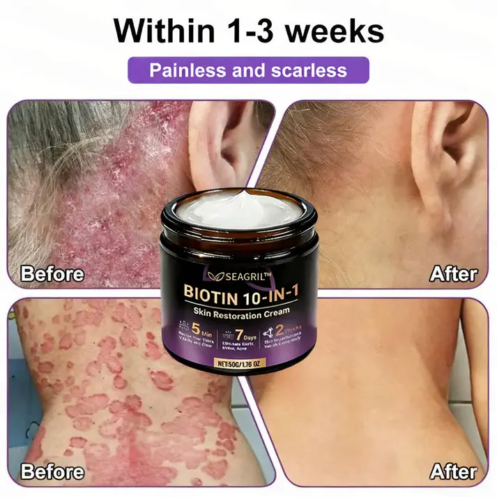 Biotin 10-in-1 Skin Restoration Cream - Image 6