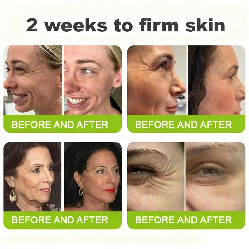 👏🌿Made and shipped from the USA Botox & Vita-A Retinol Shot Wrinkle-Lift Tightening cream - Last Day Promotion 70% OFF - Image 3