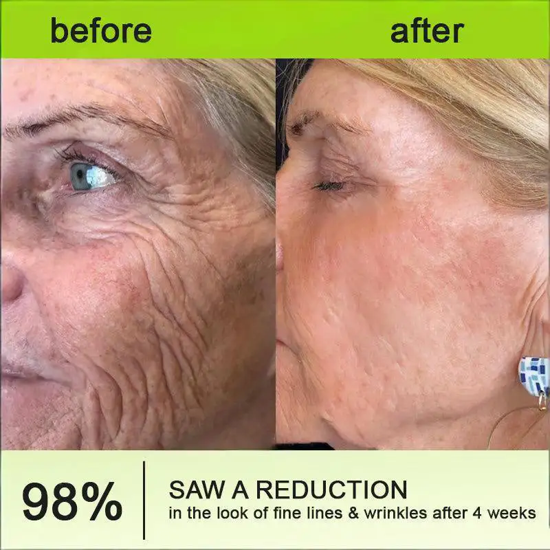 Made and shipped from the USA Botin & Vita-A Retinol Shot Wrinkle-Lift Tightening cream - Last Day Promotion 50% OFF - Image 3