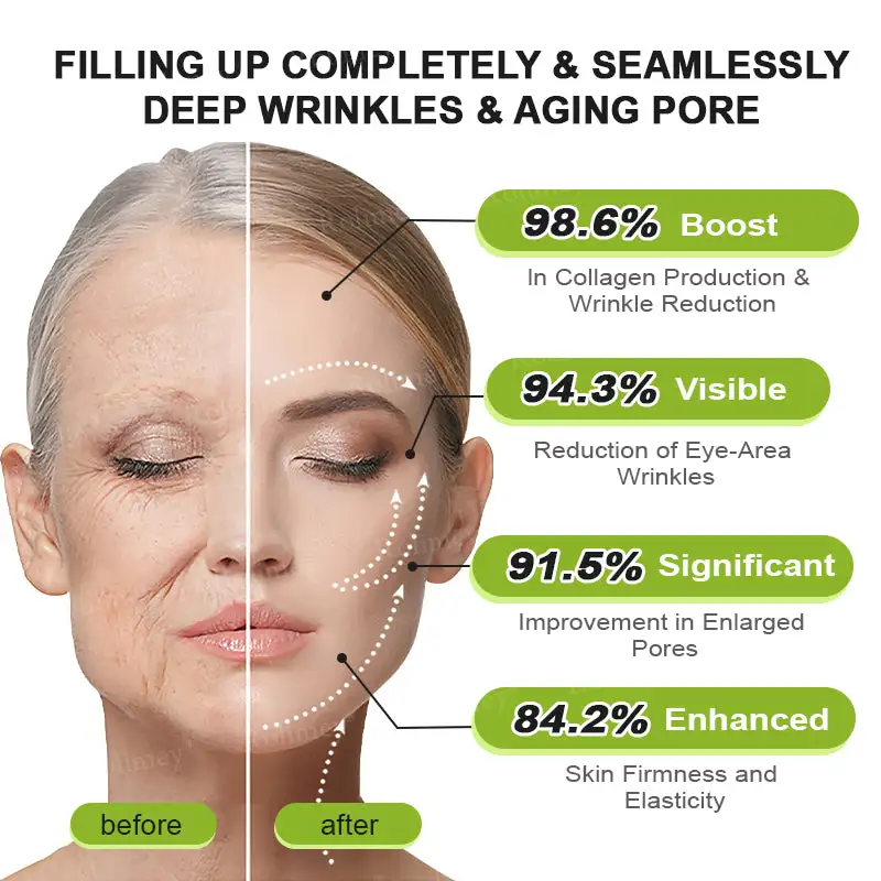 Made and shipped from the USA 🎉 Botox & Vita-A Retinol Shot Wrinkle-Lift Tightening Cream - Image 17