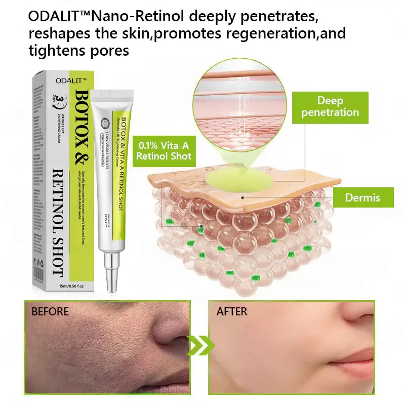 Botox & Retinol Shot - Image 5