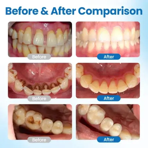 NanoHAP Tooth Defense Serum - Image 5